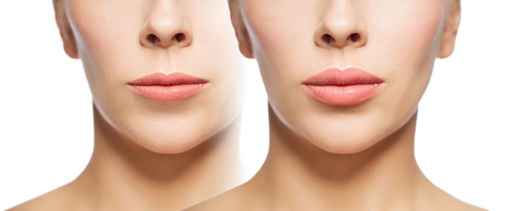 cosmetic surgery before and after